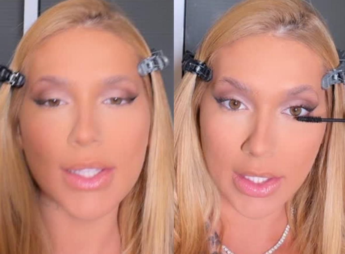 Virginia explica origem das manchas no rosto e fala sobre batalha contra acne