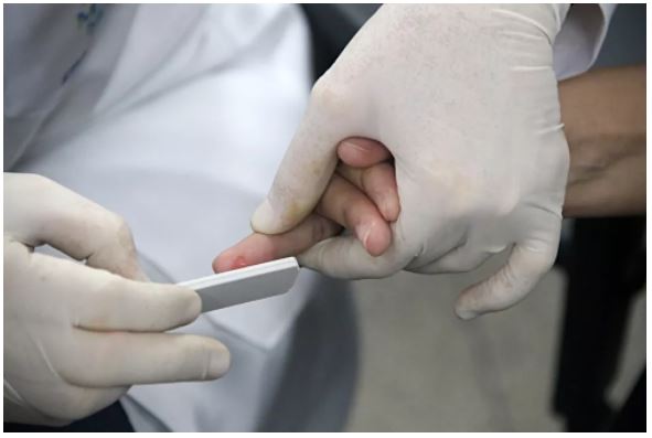 Brasil registra 27,3 mil casos novos casos de Covid em 24h