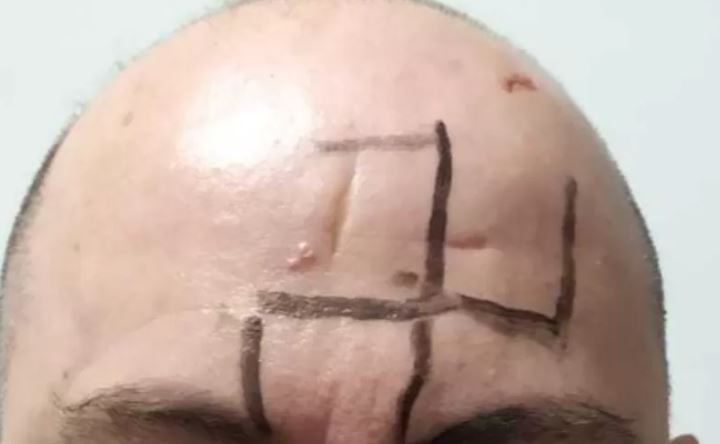 Homem gay é dopado e tem ameaças gravadas pelo corpo