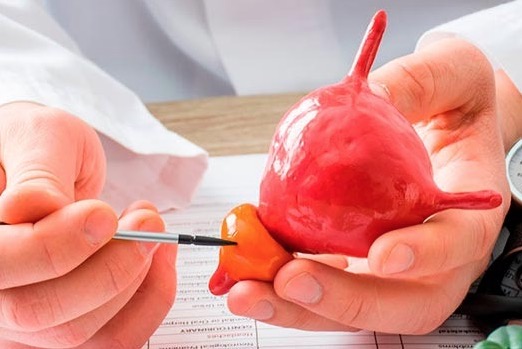 Alerta: 25% dos homens entre 40 a 49 anos podem ter o aumento benigno da próstata