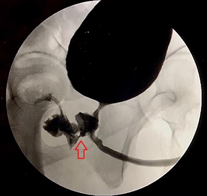 Condição rara faz homem passar 2 anos ejaculando pelo ânus e defecando pelo pênis