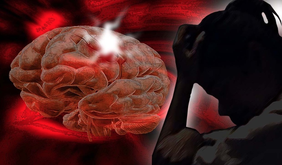 Estudos apontam aumento da incidência de AVC em mulheres jovens