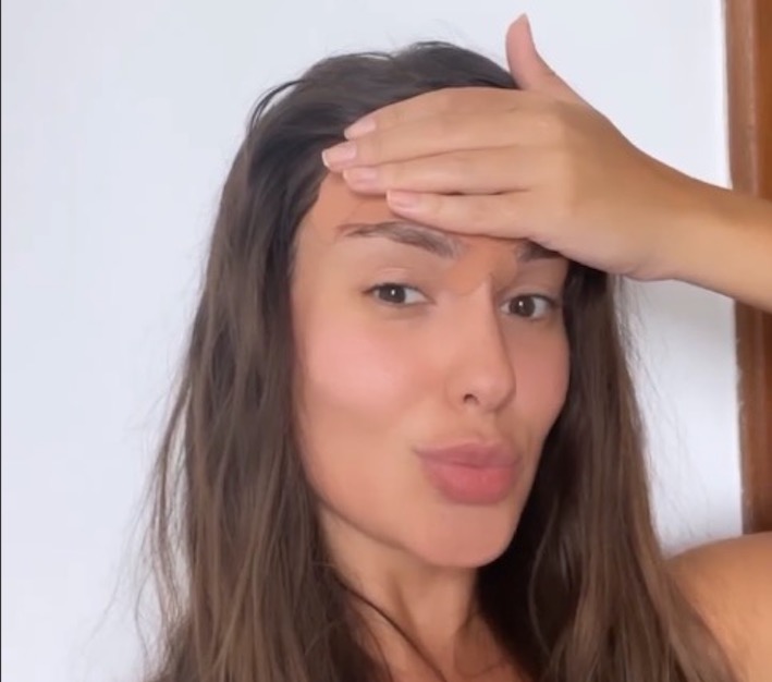 Saiba detalhes da cirurgia de 'encurtamento de testa' feito pela ex-BBB Thaís Braz