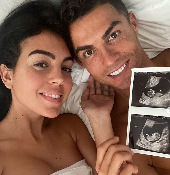 Após morte de filho de Cristiano Ronaldo, especialista explica riscos na gestação de gêmeos