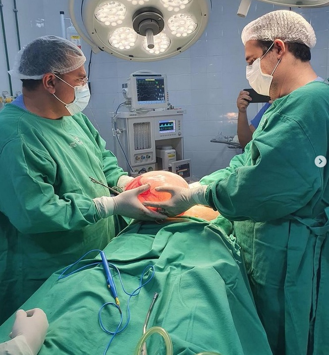 Idosa passa 1 mês com dor abdominal e médicos descobrem cisto de 5 kg; veja