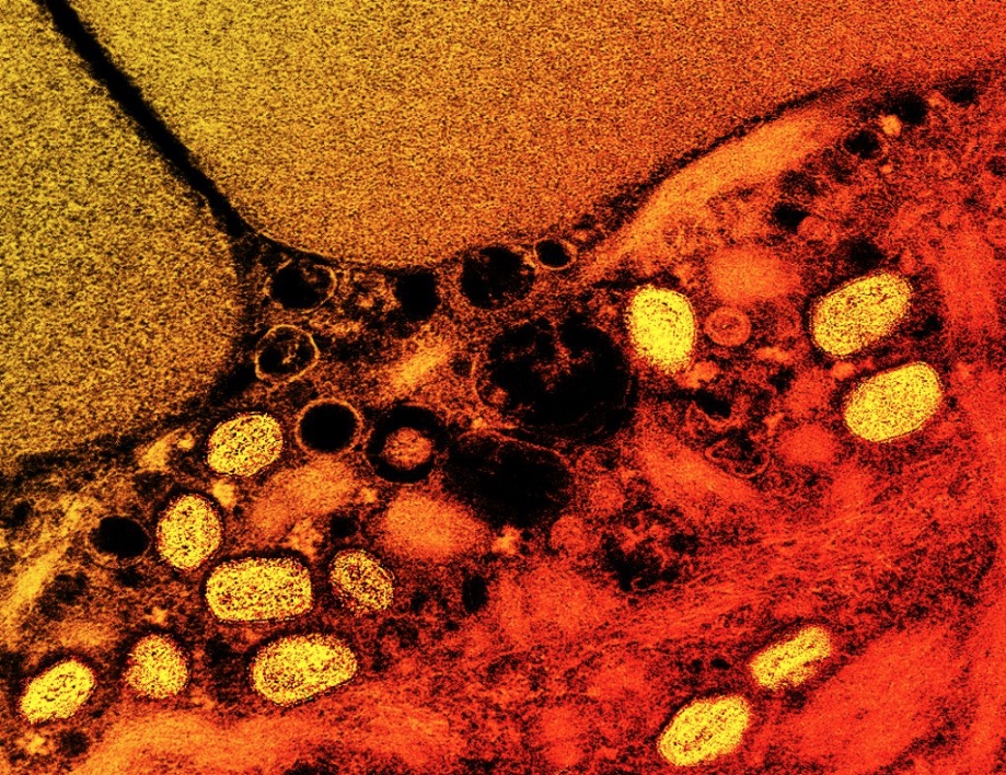 Sem medicação, varíola dos macacos pode causar cegueira