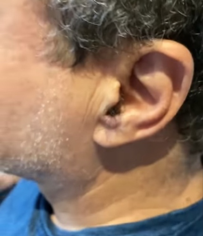 Saiba porque homens na faixa dos 50 anos começam a ter mais pelos na orelha e no nariz