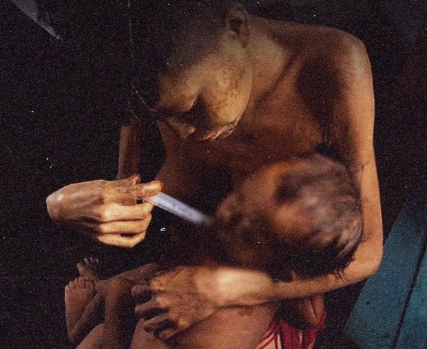 Entenda porque crianças yanomamis expelem vermes pela boca