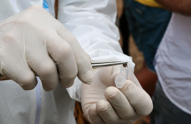 Especialista ensina como retirar carrapato da pele com segurança