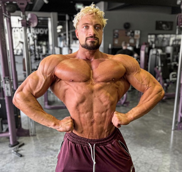 Fisiculturista morto por aneurisma aos 30: conheça os riscos dos anabolizantes