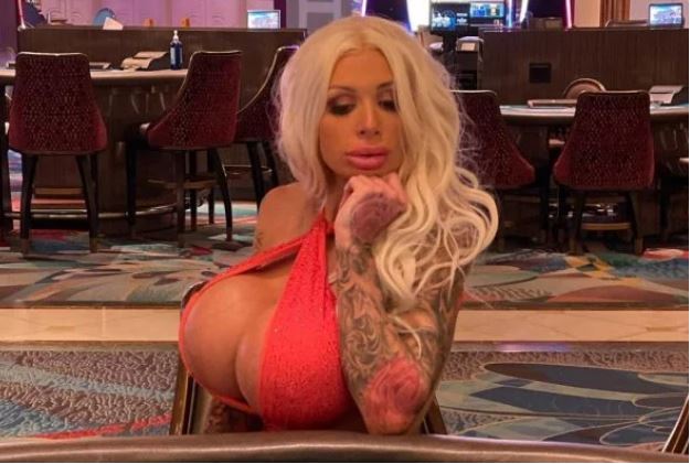 Atriz pornô mostra foto de como ficou seio após prótese de silicone explodir