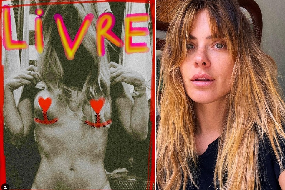 Carolina Dieckmann faz relato após retirar próteses de silicone: 'se voltasse no tempo, não faria'