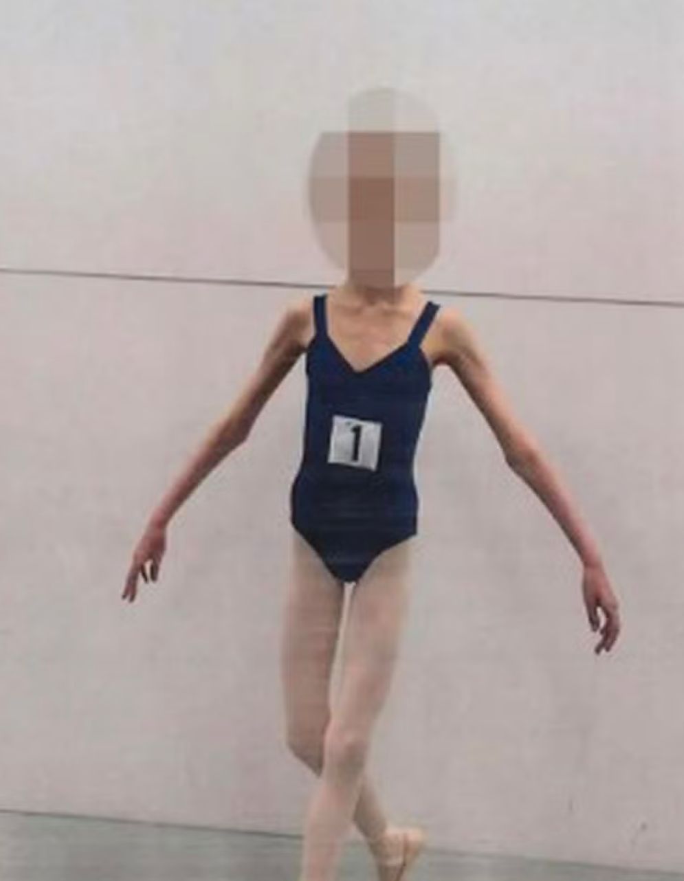 Pais são condenados por deixar filha adolescente esquelética para manter aparência de criança