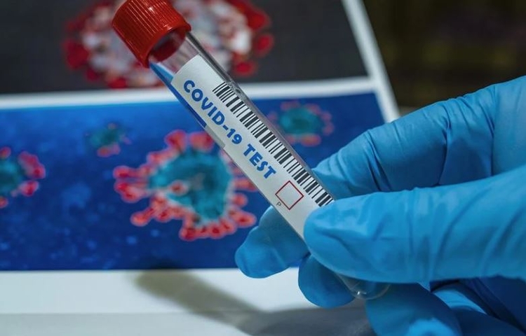 Covid-19: Brasil registra 339 óbitos e 70,3 mil casos em 24 horas