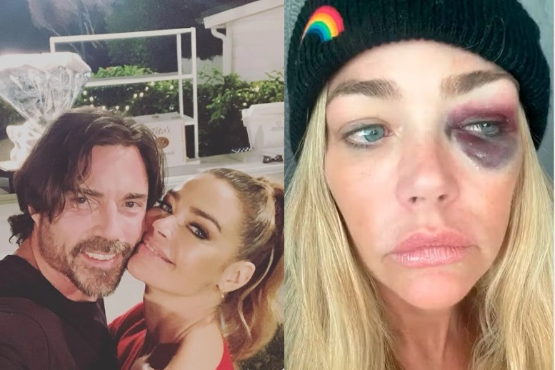 Atriz Denise Richards acusa marido de agressão, ameaça e anos de abuso