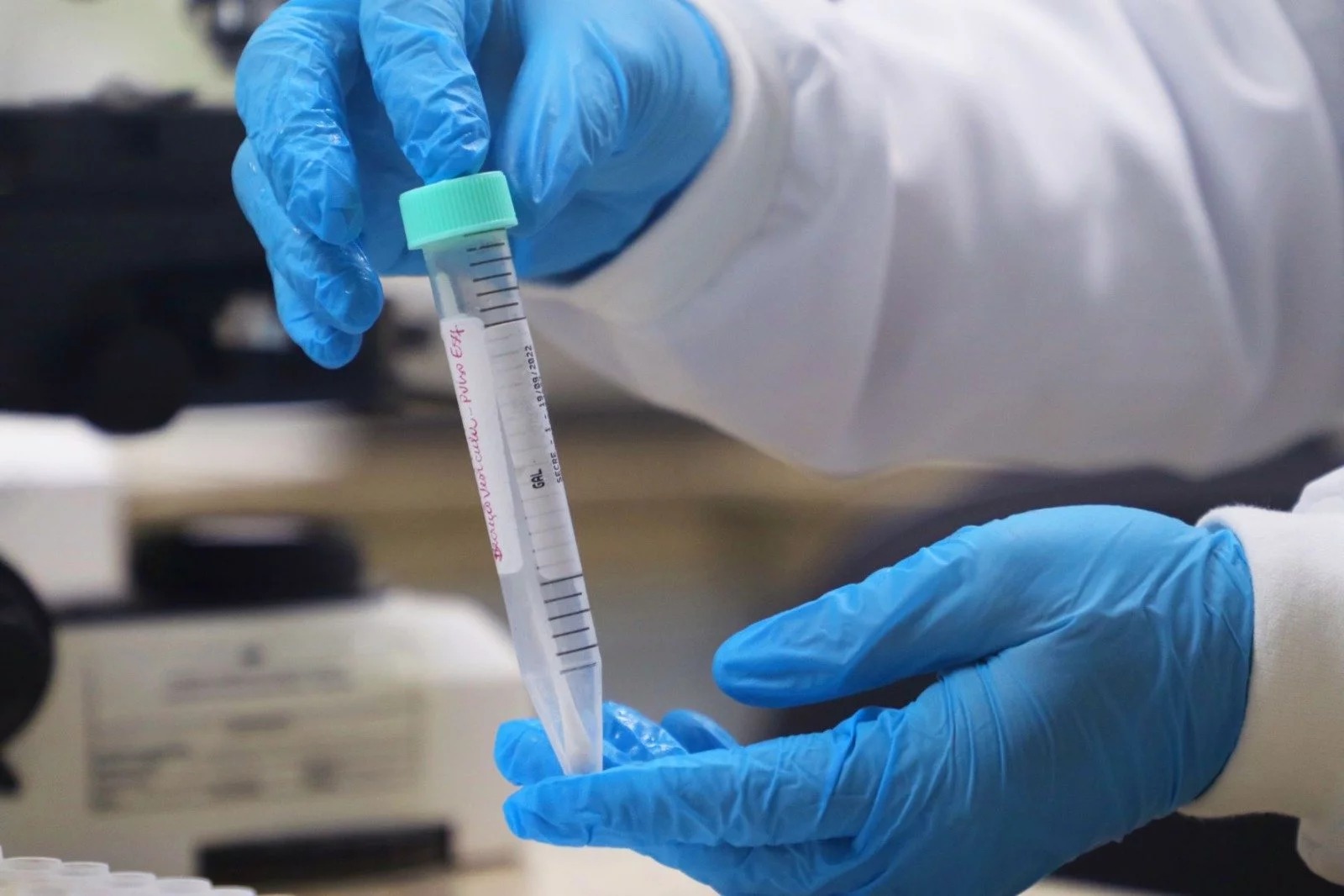 Covid-19, Influenza A e Rinovírus somam 55 dos 62 óbitos por SRAG no Amazonas