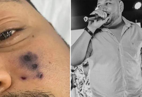Cantor de forró morre após ser picado por aranha; filha está internada
