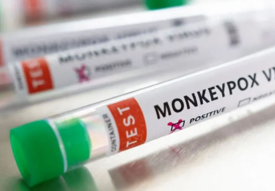 Anvisa aprova registro do primeiro teste da varíola dos macacos