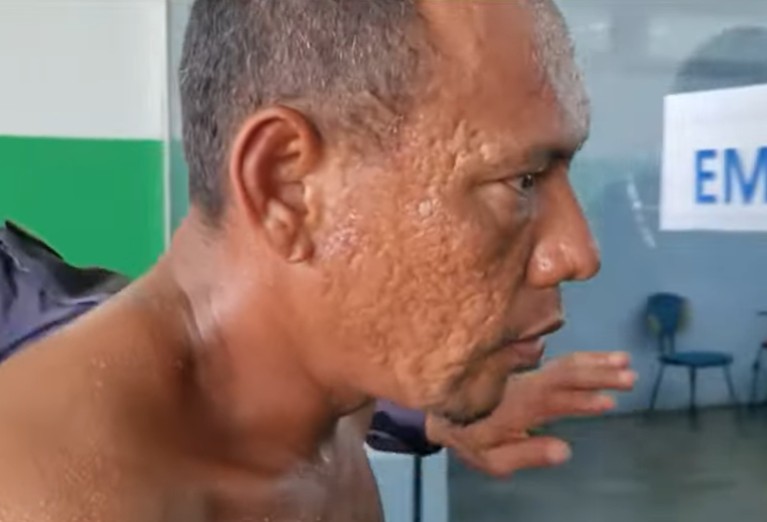 Suspeito de espancar mototaxista a pauladas durante assalto é preso em Manacapuru