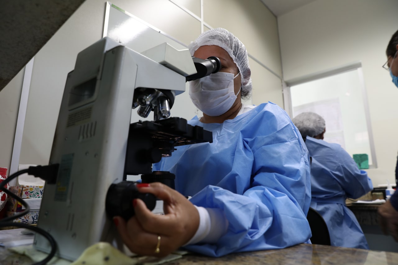 Lacen aumenta rede de laboratórios de tuberculose em municípios do Amazonas