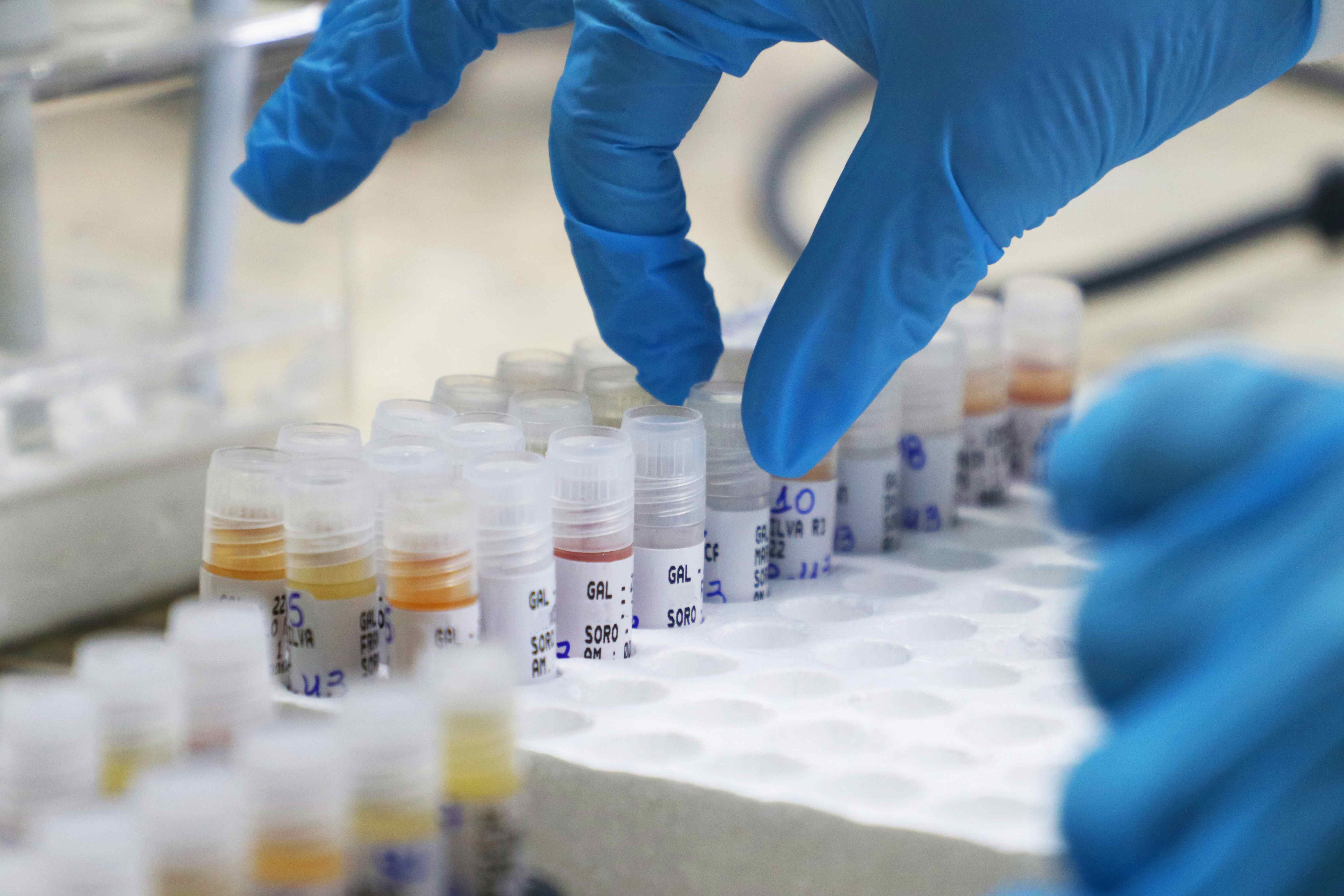 FVS divulga dados sobre a Mpox no Amazonas e reforça medidas de prevenção