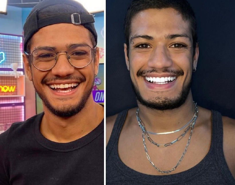 Após o BBB23, Gabriel Santana coloca lente de contato nos dentes e mostra resultado