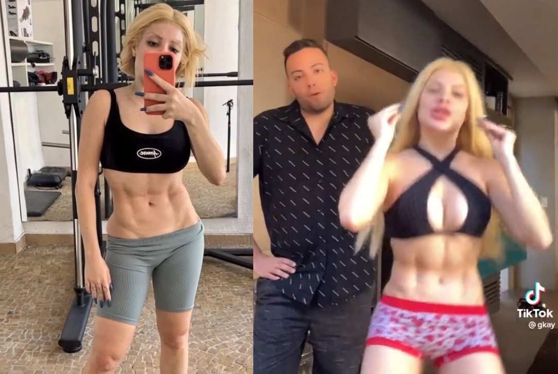 GKay tem corpo criticado após plásticas e rebate; veja o 'antes x depois'