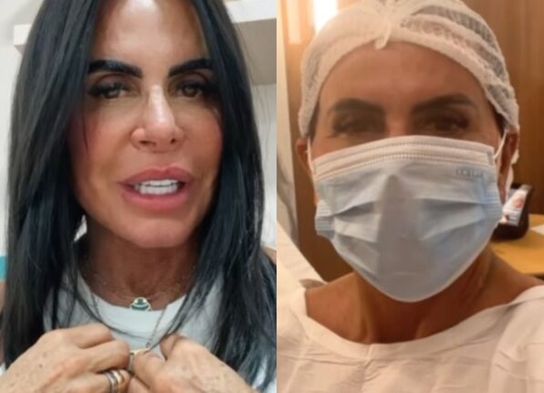 Gretchen passa por cirurgia para retirar útero em tratamento de doença 