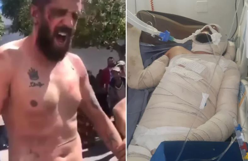 Jogador ateia fogo no próprio corpo após ser acusado de terrorismo