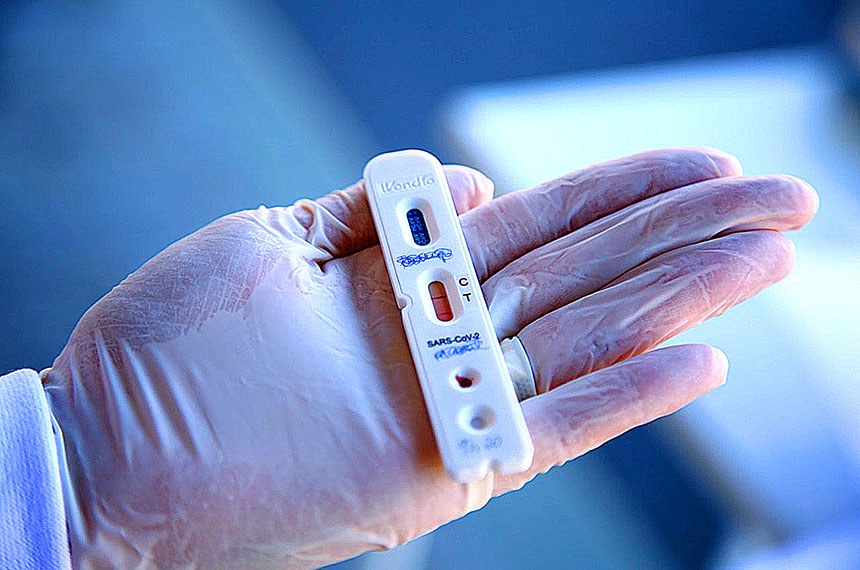 PL estabelece distribuição de autoteste de covid a beneficiários do Auxílio Brasil