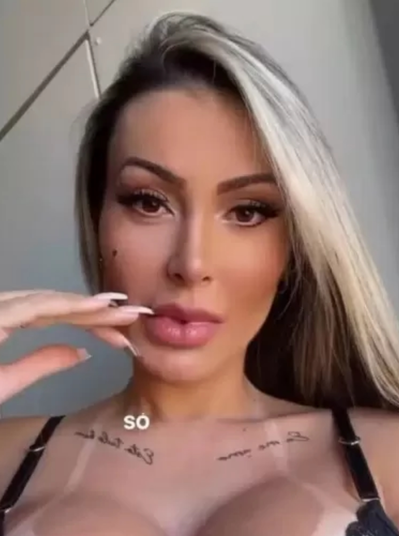 Andressa Urach passa por novo procedimento na língua após cirurgia
