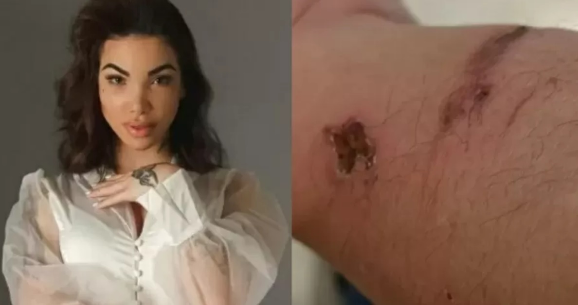 Torturado por influencer conta detalhes do crime: 'facadas na sola do pé' 