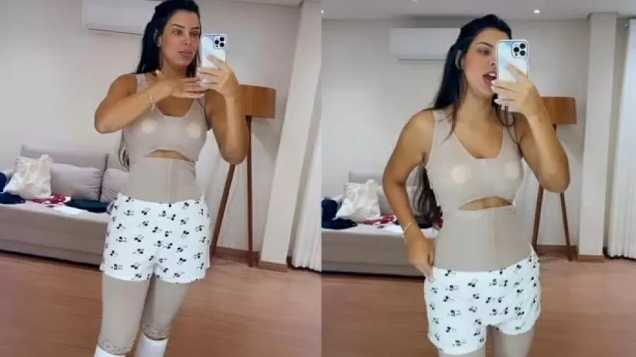 Ex-BBB Ivy Moraes faz recauchutagem com lipoaspiração: ‘mexi em tudo’