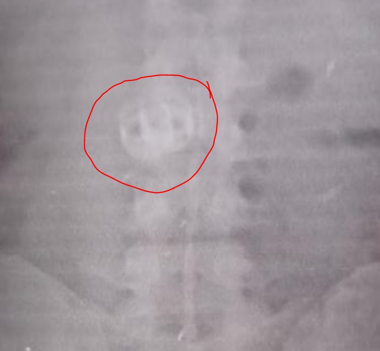 Homem rouba alianças de turistas e engole joias para despistar polícia