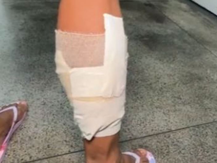 Mulher leva tiros ao negar entregar celular para assaltantes em Manaus