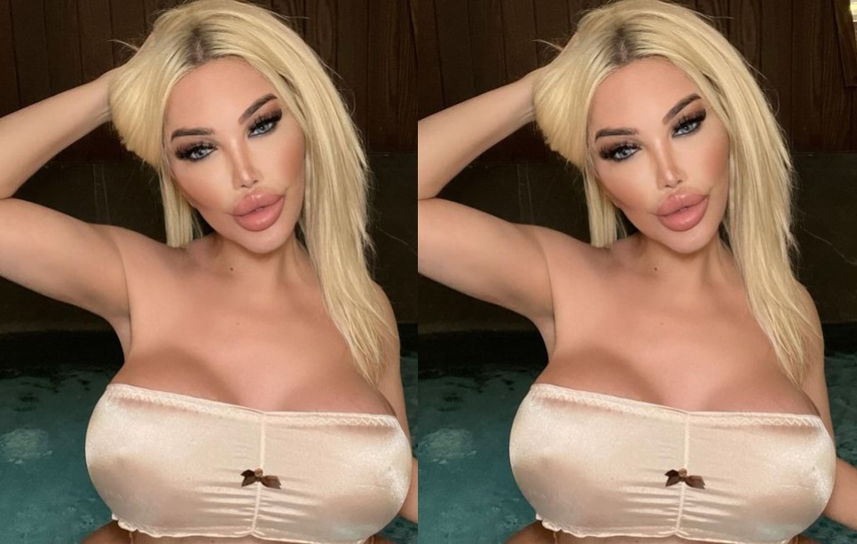 Jéssica Alves passa por novo procedimento no rosto na Turquia e choca com resultado 