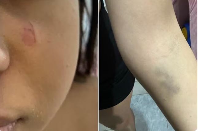 Adolescente é espancada por pedir pix de R$ 10 ao primo