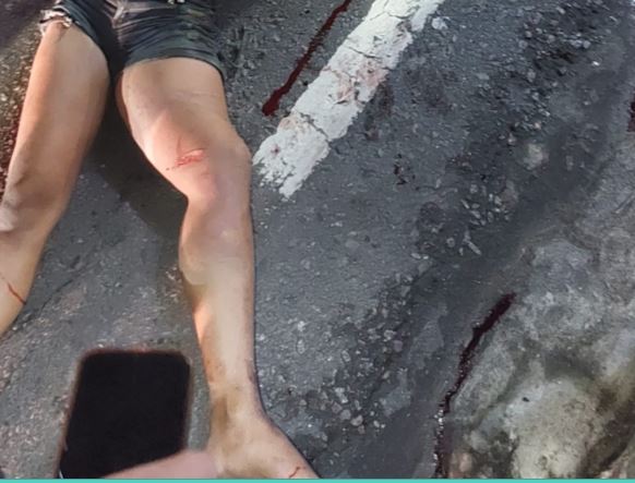 Mulher morre após ser atropelada em avenida de Manaus 