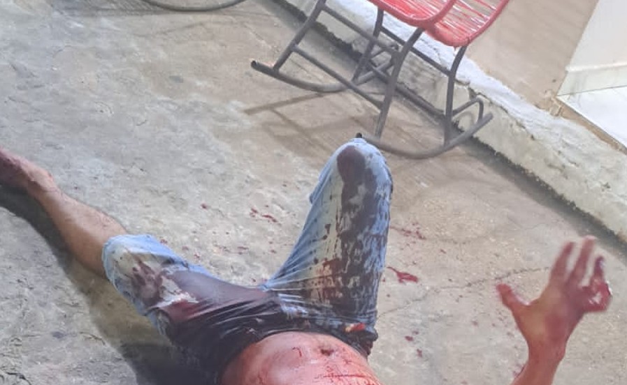 Homem é atacado a pauladas e esfaqueado em centro de eventos em Itacoatiara