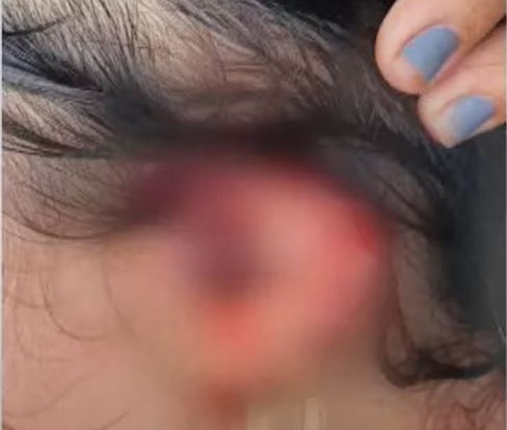 Mulher é atacada pelo marido e tem orelha cortada no Amazonas