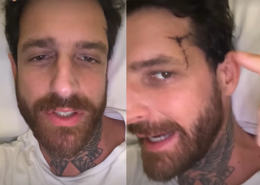 Marido de Cleo grava vídeo após sair da UTI por acidente de skate: 'mandem boas energias'