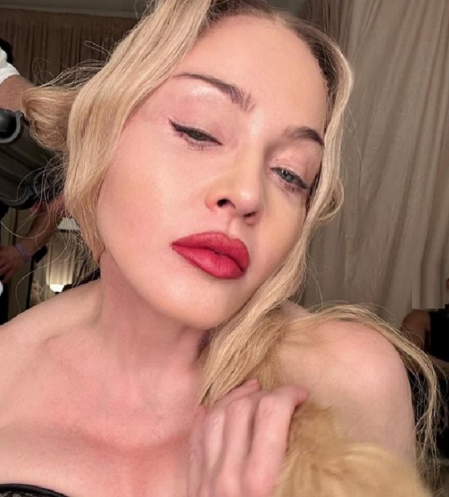 Madonna se pronuncia pela 1ª vez após internação: 'Estou me recuperando'
