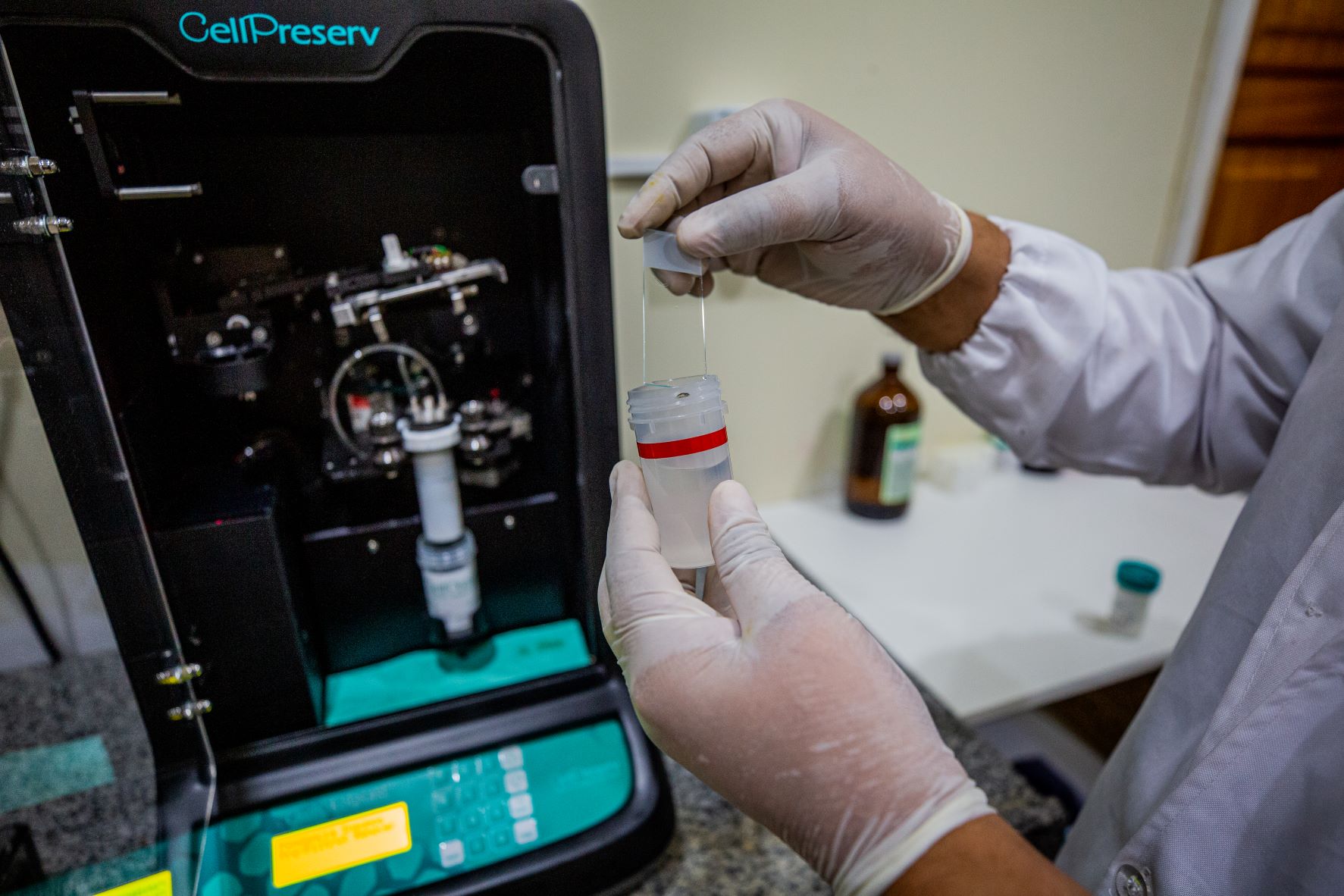 Março Lilás: Campanha para prevenção do câncer do colo do útero começa quarta-feira em Manaus