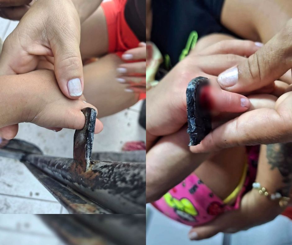 Bombeiros são acionados após criança de 3 anos prender o dedo em portão em Manaus