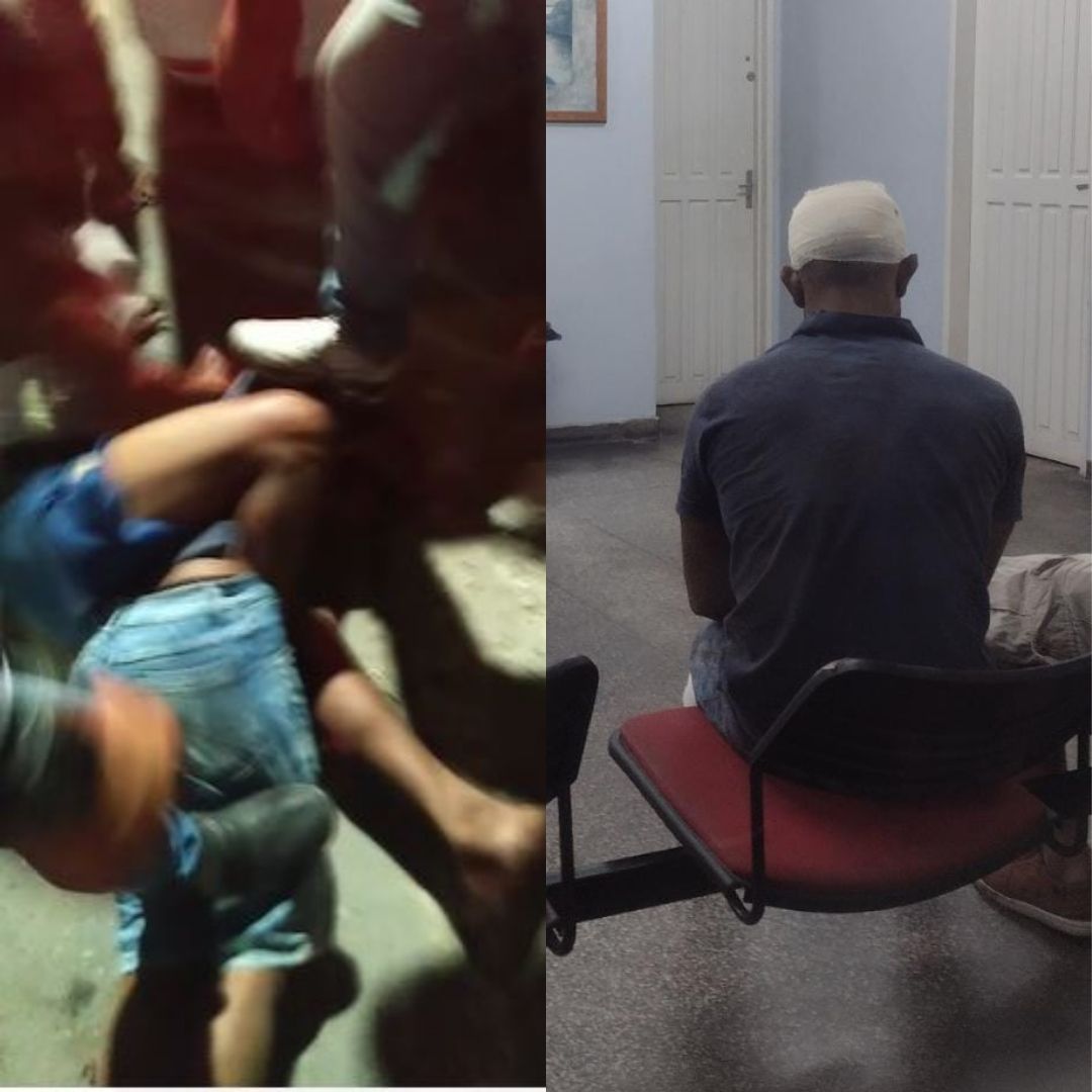 Sargento do Exército é espancado por populares ao ser confundido com ladrão em Manaus