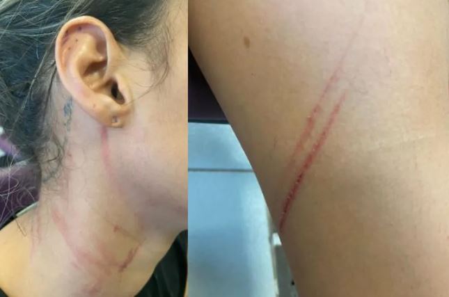 Mulher é espancada por recusar fazer sexo com namorado