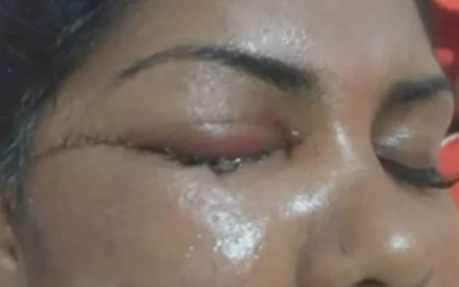 Mulher leva facada e perde visão por ouvir samba que homenageia Exu