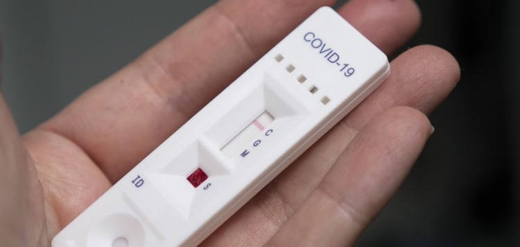 Justiça nega pedido da DPE para testagem em massa no Amazonas