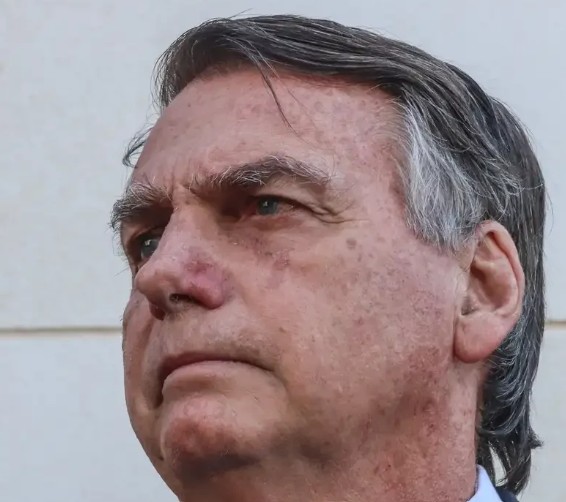Bolsonaro alega dores de cabeça intensas devido a barulho de gerador na PF