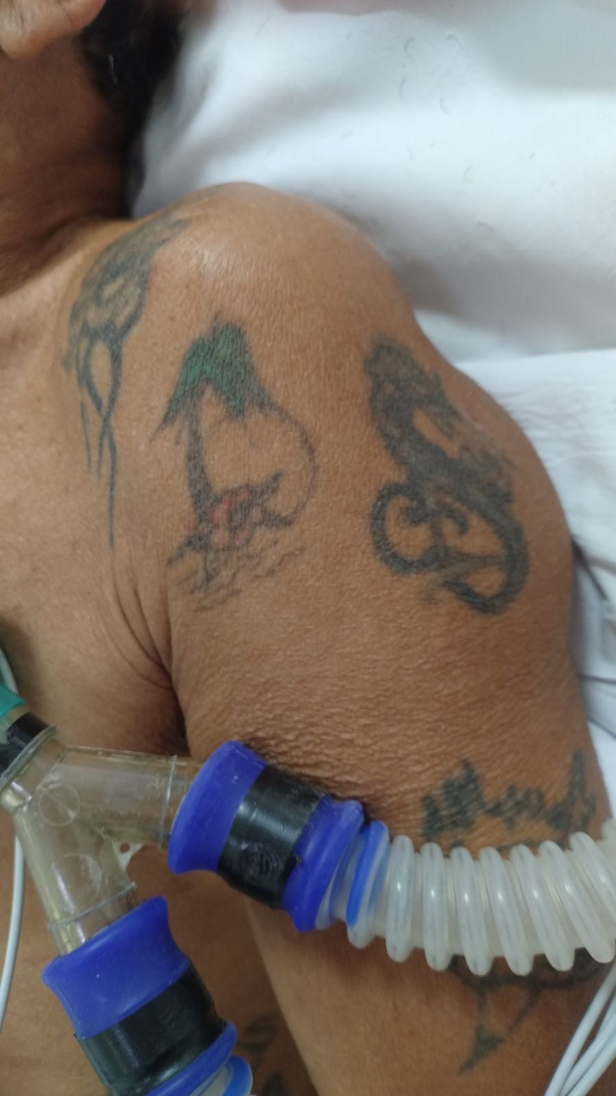 HPS João Lúcio busca familiares de três pacientes vítimas de atropelamento